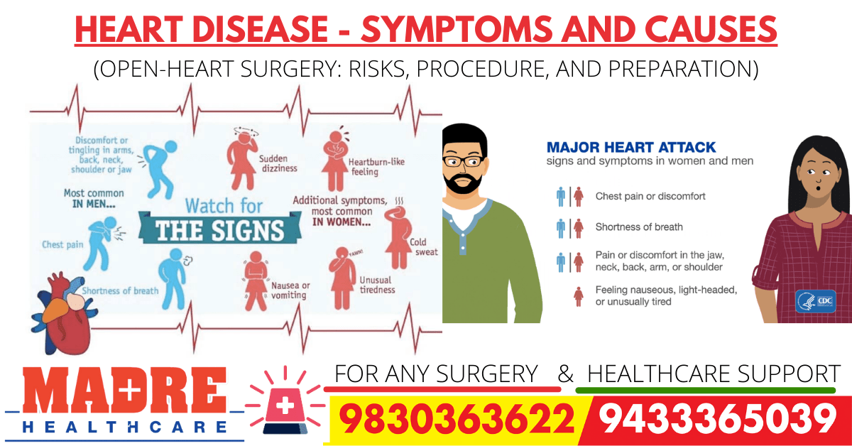Heart disease - Symptoms and causes-(Open-Heart Surgery Risks, Procedure, and Preparation)-min