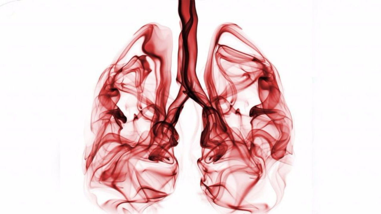 Lung Cancer