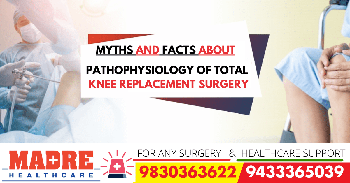 MYTHS and FACTS About Pathophysiology Of Total Knee Replacement Surgery