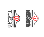 Hernia Surgery