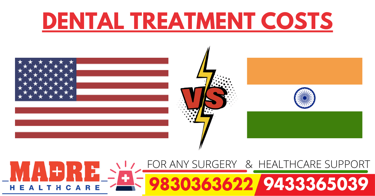 Comparison between different dental treatment costs in the US and India-min