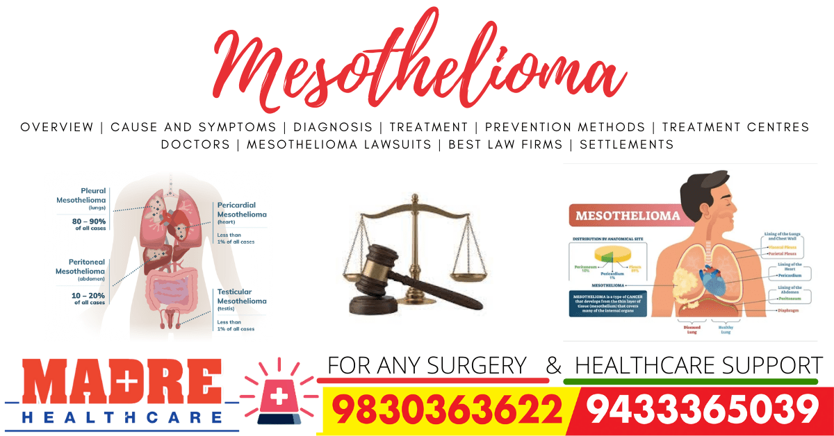 Mesothelioma Overview Cause and Symptoms Diagnosis Treatment Prevention Methods Treatment Centres Doctors Mesothelioma Lawsuits Best Law Firms Settlements-min