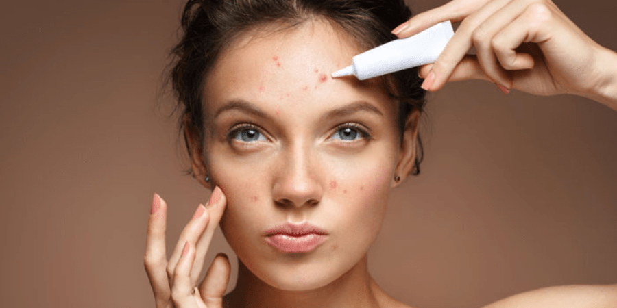 Best Acne Skin Care Treatment