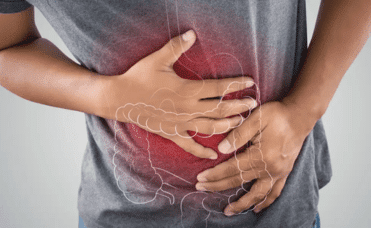 Colon Cancer