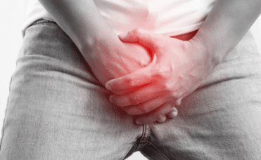 Penile Cancer
