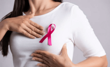 Breast Cancer
