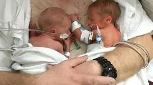 ivf twins