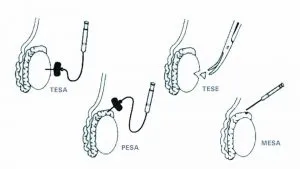 Tesa Tese 31d9965toso09cpz2pcwe8
