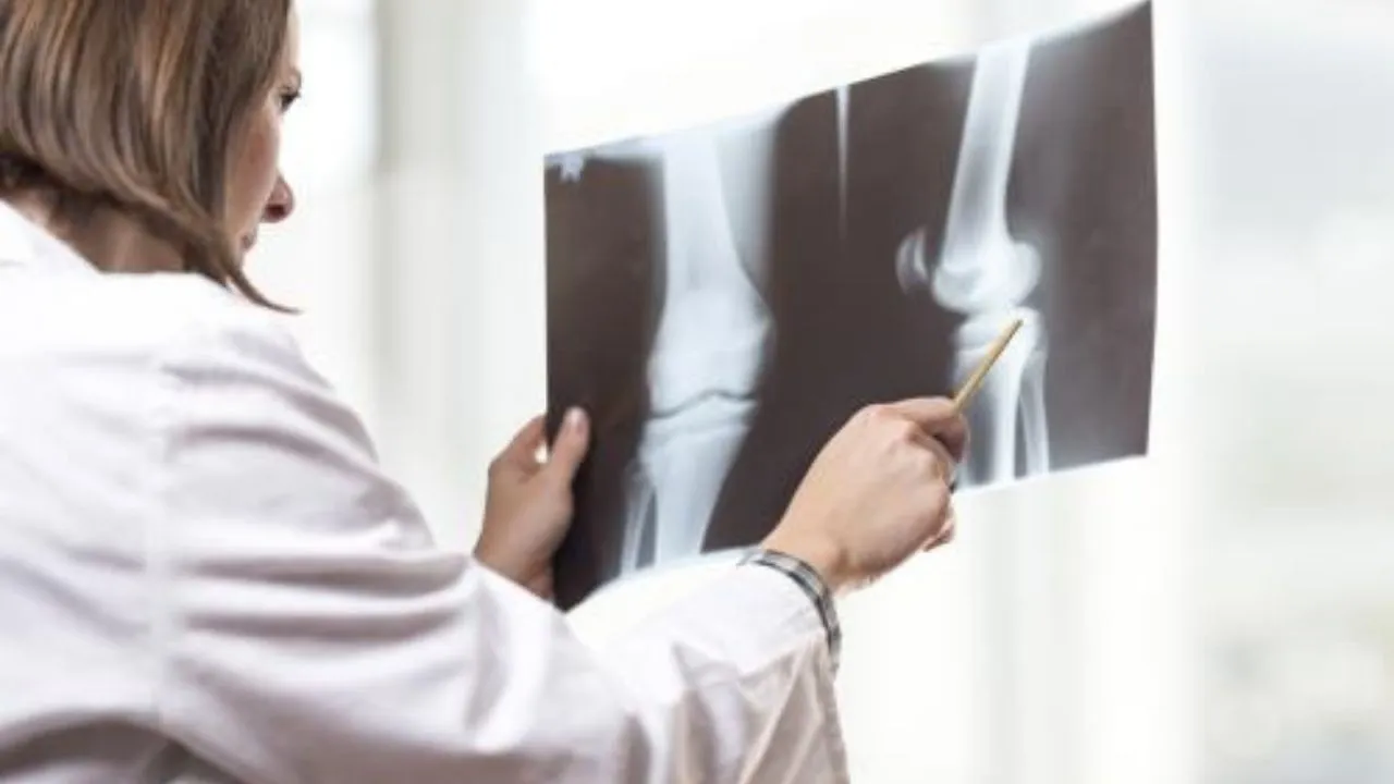 SYMPTOMS OF KNEE PAIN 5