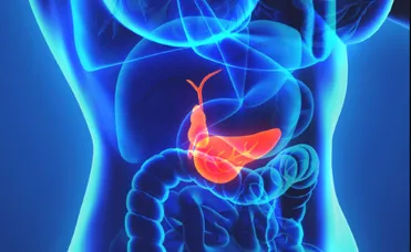 Gallblader Stone Surgery